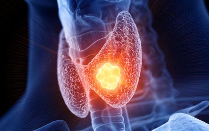 A 10 anni dalla sua istituzione, l’Osservatorio Italiano dei Carcinomi Tiroidei (ITCO) ha presentato al Senato il Report 2025, con le nuove strategie per la diagnosi e la gestione della patologia in Italia
